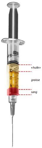 Lipostructure du visage