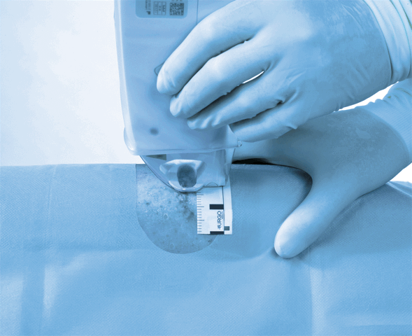 Laser UrgoTouch Dr Lahbabi